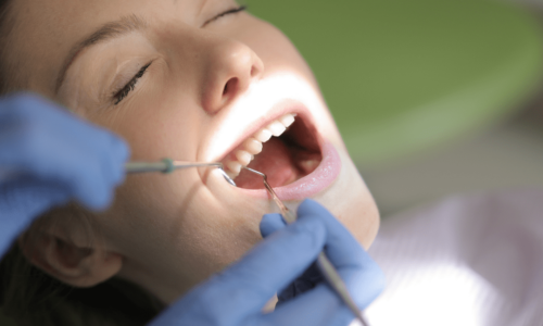 Comment favoriser l’accès aux soins bucco-dentaires en Wallonie ?